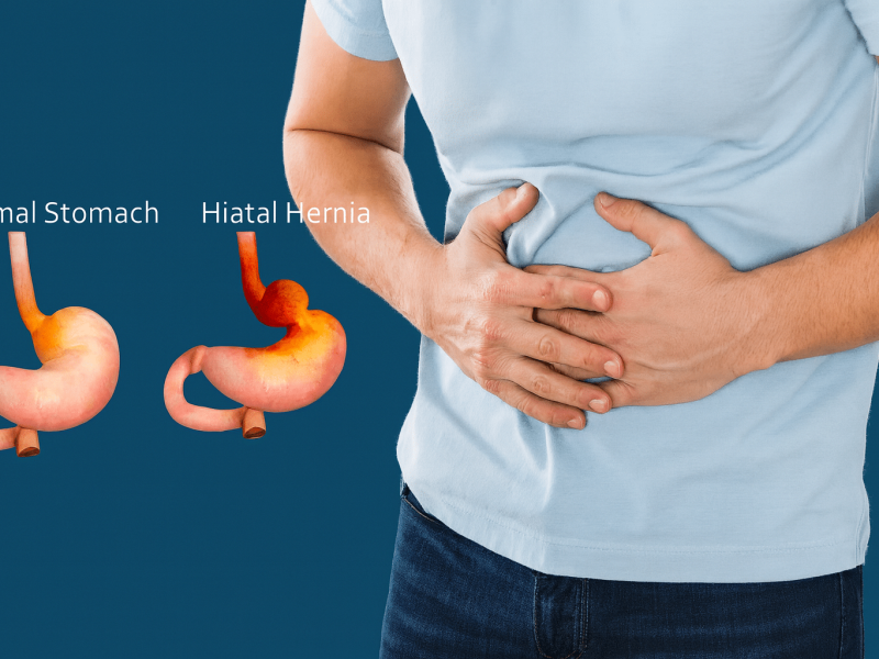 ad7b7e8e-a21f-4bc8-b9ff-d7c30d8f7778