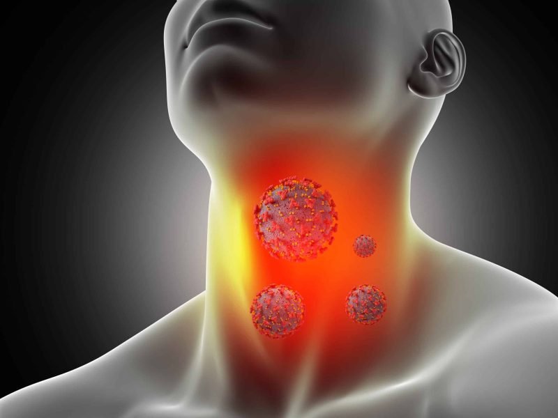3D render of a male medical figure with sore throat and corona virus cells