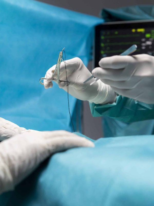 surgical-procedure-made-by-doctor (1)